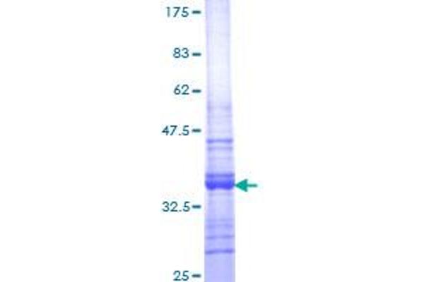 NAP1L1 Protein (AA 1-110) (GST tag)