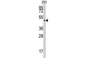 Western blot analysis of E2F1 polyclonal antibody  in 293 cell line lysates (35 ug/lane). (E2F1 antibody  (Ser332))