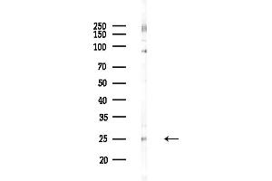 anti-Proteasome (Prosome, Macropain) 26S Subunit, Non-ATPase, 10 (PSMD10) (C-Term) antibody