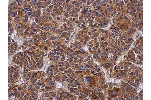 Image no. 1 for anti-Coiled-Coil Domain Containing 50 (CCDC50) (AA 1-187) antibody (ABIN1497124) (CCDC50 antibody  (AA 1-187))