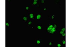 Immunofluorescent analysis of MCF-7 cells using ABIN7143011 at dilution of 1:100 and Alexa Fluor 488-congugated AffiniPure Goat Anti-Rabbit IgG(H+L) (PHAP1 antibody  (AA 1-170))