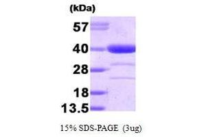 Figure annotation denotes ug of protein loaded and % gel used. (Alcohol Dehydrogenase (ADH) (AA 1-325) Protein)