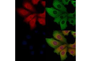 ABIN6262052 and ABIN6268767 staining Hela cells by IF/ICC.