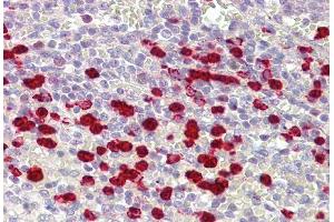 IHC Suggested Anti-ZNF746 antibody  Titration: 5ug/ ml Positive Control: Spleen (ZNF746 antibody  (Middle Region))