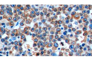 Immunohistochemistry (IHC) image for anti-HLA-DR-gamma (CD74) (AA 78-222) antibody (ABIN7443692)