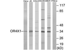 Western blot analysis of extracts from HeLa/Jurkat/HuvEc/MCF-7/COLO cells, using OR4X1 Antibody.