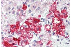 Human Adrenal (formalin-fixed, paraffin-embedded) stained with LASS6 antibody ABIN396945 at 5 ug/ml followed by biotinylated goat anti-rabbit IgG secondary antibody ABIN481713, alkaline phosphatase-streptavidin and chromogen. (CERS6 antibody  (N-Term))