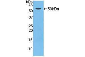 Western blot analysis of recombinant Rat CTSD. (Cathepsin D antibody  (AA 120-407))