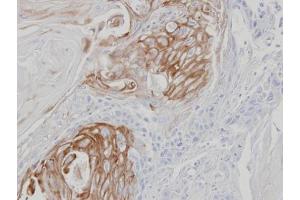 IHC-P Image Immunohistochemical analysis of paraffin-embedded SCC25 xenograft, using ZPBP, antibody at 1:100 dilution.