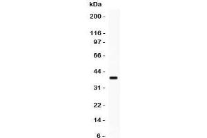 Western blot testing of HOXA11 antibody and recombinant human protein (0. (Homeobox A11 antibody  (AA 74-245))