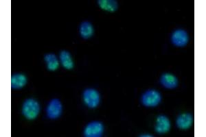 Detection of NPM1 in Human MCF7 Cell using Polyclonal Antibody to Nucleophosmin 1 (NPM1) (NPM1 antibody  (AA 212-292))