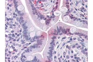 Immunohistochemical analysis of paraffin-embedded human Small Intestine tissues using FABP2 mouse mAb (FABP2 antibody)