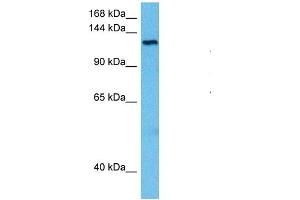 Host:  Rat  Target Name:  TRPM4  Sample Tissue:  Rat Brain  Antibody Dilution:  1ug/ml (TRPM4 antibody  (N-Term))