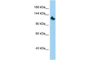 Host: Rabbit Target Name: KIF24 Sample Type: HepG2 Whole Cell lysates Antibody Dilution: 1. (KIF24 antibody  (N-Term))