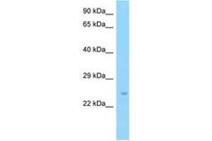 Image no. 1 for anti-Solute Carrier Family 9 (Sodium/hydrogen Exchanger), Member 3 Regulator 2 (SLC9A3R2) (AA 124-173) antibody (ABIN6748141)