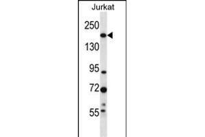 UGCGL1 Antibody (C-term) (ABIN657069 and ABIN2846232) western blot analysis in Jurkat cell line lysates (35 μg/lane). (UGGT1 antibody  (C-Term))