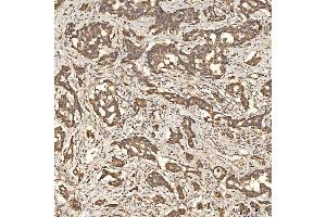 IHC analysis of SLC25A24 using anti-SLC25A24 antibody (ABIN7599228).