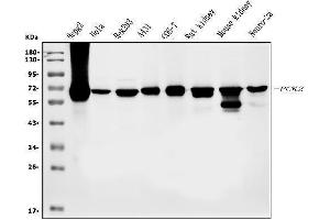 Western blot analysis of PCK2 using anti-PCK2 antibody (ABIN7599509).
