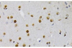 Immunohistochemistry of paraffin-embedded Rat brain using Phospho-CREB1(S133) Polyclonal Antibody at dilution of 1:200 (40x lens). (CREB1 antibody  (pSer133))