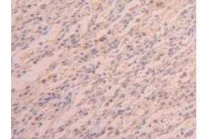 DAB staining on IHC-P; Samples: Human Spleen Tissue (PABPC1L antibody  (AA 187-368))