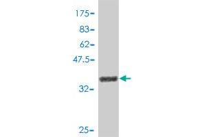 Western Blotting (WB) image for anti-Hypoxia Inducible Factor 1, alpha Subunit (Basic Helix-Loop-Helix Transcription Factor) (HIF1A) (AA 717-826) antibody (ABIN561260)