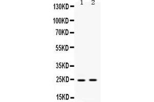 Western blot analysis of HMGB2 expression in rat liver extract ( Lane 1) and human placenta extract ( Lane 2). (HMGB2 antibody  (N-Term))