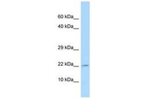 Image no. 1 for anti-Thymic Stromal Lymphopoietin (TSLP) (AA 89-138) antibody (ABIN6747937) (Thymic Stromal Lymphopoietin antibody  (AA 89-138))