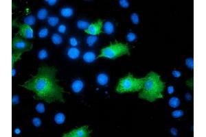 Anti-ARFGAP1 mouse monoclonal antibody (ABIN2454352) immunofluorescent staining of COS7 cells transiently transfected by pCMV6-ENTRY ARFGAP1 (RC206987). (ARFGAP1 antibody)