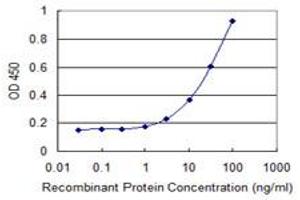 Detection limit for recombinant GST tagged ATXN7L1 is 1 ng/ml as a capture antibody. (ATXN7L1 antibody  (AA 1-146))