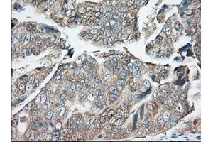 Immunohistochemical staining of paraffin-embedded Human Kidney tissue using anti-BDH2 mouse monoclonal antibody. (BDH2 antibody)