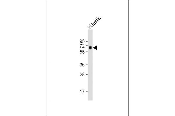 HIPK4 Antikörper  (C-Term)