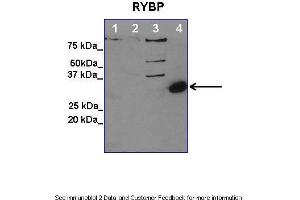 Lanes:   1. (RYBP antibody  (Middle Region))