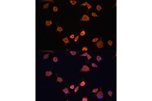 Immunofluorescence analysis of L929 cells using NF2 antibody (ABIN6128275, ABIN6144548, ABIN6144551 and ABIN7101344) at dilution of 1:100. (Merlin antibody  (AA 477-576))