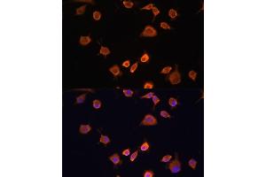 Immunofluorescence analysis of L929 cells using NF2 antibody (ABIN6128275, ABIN6144548, ABIN6144551 and ABIN7101344) at dilution of 1:100. (Merlin antibody  (AA 477-576))