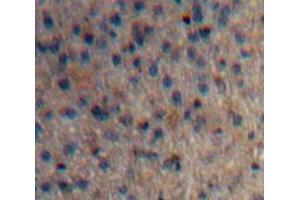 Used in DAB staining on fromalin fixed paraffin-embedded Liver tissue (Huntingtin antibody  (AA 782-920))