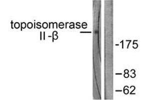 Western blot analysis of extracts from Jurkat cells, using TOP2B Antibody. (TOP2B antibody  (AA 1-50))