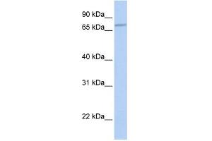 WB Suggested Anti-CABC1 Antibody Titration:  0. (COQ8A antibody  (N-Term))