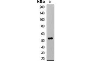 Western blot analysis of Alpha-tubulin (AcK40) expression in HeLa (A) whole cell lysates. (alpha Tubulin antibody  (acLys40))