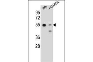 GNAS Antibody (C-term) (ABIN656989 and ABIN2850497) western blot analysis in 293,NCI- cell line lysates (35 μg/lane). (GNAS antibody  (C-Term))