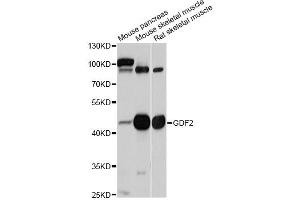 Western blot analysis of extracts of various cell lines, using GDF2 antibody (ABIN5997784) at 1/1000 dilution. (GDF2 antibody)