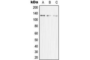 Western blot analysis of MCM2 expression in HeLa (A), Jurkat (B), HeLa (C) whole cell lysates.