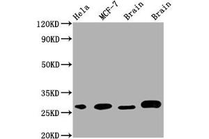 Western Blot Positive WB detected in: Hela whole cell lysate, MCF-7 whole cell lysate, Mouse Brain whole cell lysate, Rat Brain whole cell lysate All lanes: GRB2 antibody at 1:1000 Secondary Goat polyclonal to rabbit IgG at 1/50000 dilution Predicted band size: 26, 21 kDa Observed band size: 28 kDa (Recombinant GRB2 antibody)