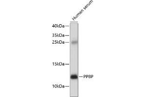 Western blot analysis of extracts of human serum, using PPBP antibody  at 1:1000 dilution. (CXCL7 antibody  (AA 31-128))