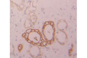 Figure. (PTPRG antibody  (AA 848-1119))