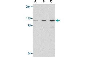 Western blot analysis of GRIK1 in P815 cell lysate with GRIK1 polyclonal antibody  at (A) 0.