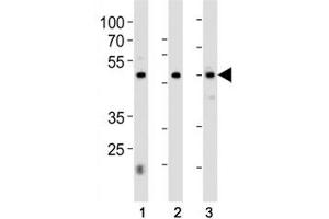 HNF4A antibody western blot analysis in 1) 293, 2) HepG2 cell line and 3) rat liver tissue lysate.