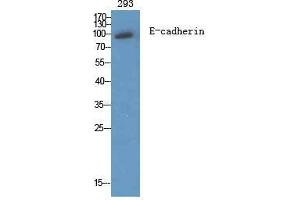 Western Blot (WB) analysis of specific cells using E-cadherin Polyclonal Antibody. (E-cadherin antibody  (C-Term))