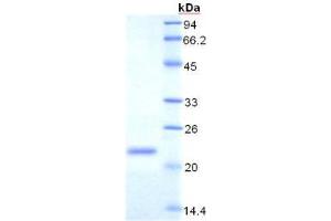 SDS-PAGE analysis of Rat Transferrin Receptor Protein.