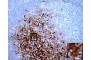 Paraffin embedded scrapie-infected sheep retropharyngeal lymph node section was stained with anti-120 kDa followed by Rat Anti-Mouse IgM-HRP (Rat anti-Mouse IgM (Chain mu) Antibody (HRP))