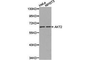 Western Blotting (WB) image for anti-V-Akt Murine Thymoma Viral Oncogene Homolog 2 (AKT2) antibody (ABIN1870912) (AKT2 antibody)
